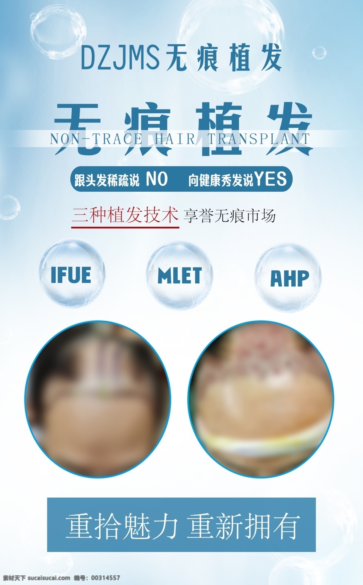 植發(fā) 植發(fā)廣告 植發(fā)案例廣告 植發(fā)對(duì)比圖 種植頭發(fā) 植發(fā)海報(bào) 醫(yī)美海報(bào) 美容海報(bào) 頭等大事 植得托付 醫(yī)美 海報(bào)