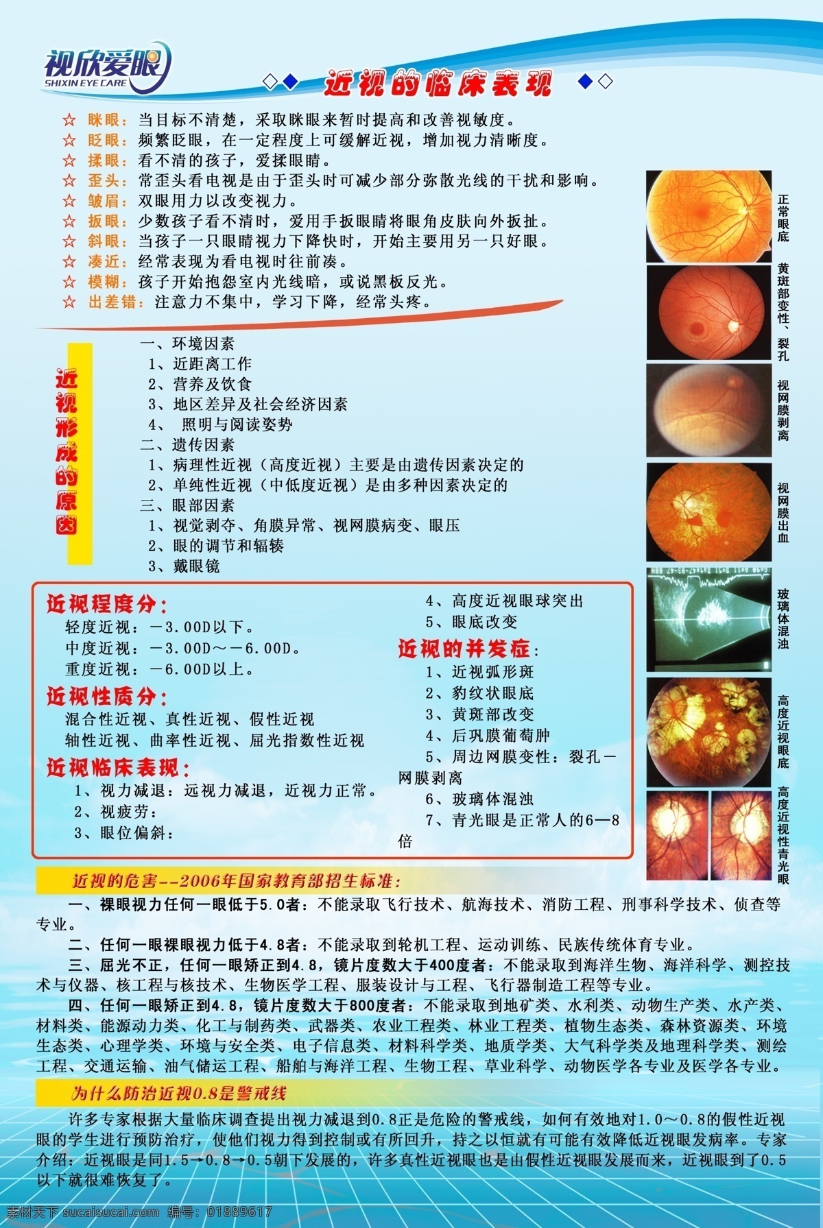 近視 臨床表現(xiàn) 形成的原因 近視的危害 近視性質 近視程度 青少年 兒童 預防近視 分層 源文件