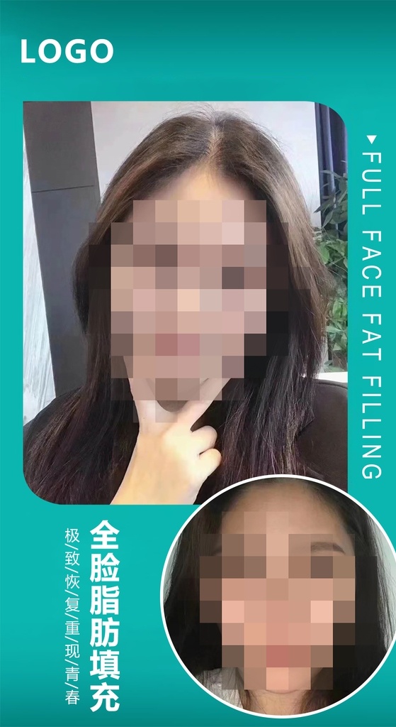 小 清新 医 美 对比 图 整形美容专题 活动专题 面部填充 整形美容 整形广告 美容 整形app 整形活动 整形电商 新氧广告 新氧整形 新氧美女 医美对比图 医美海报 美容海报 对比图 医美案例对比 医美 案例对比 整形 整容 整形对比 对比照 案例 术前 术后 手术 医疗美容 简洁 小清新 绿色 浅色