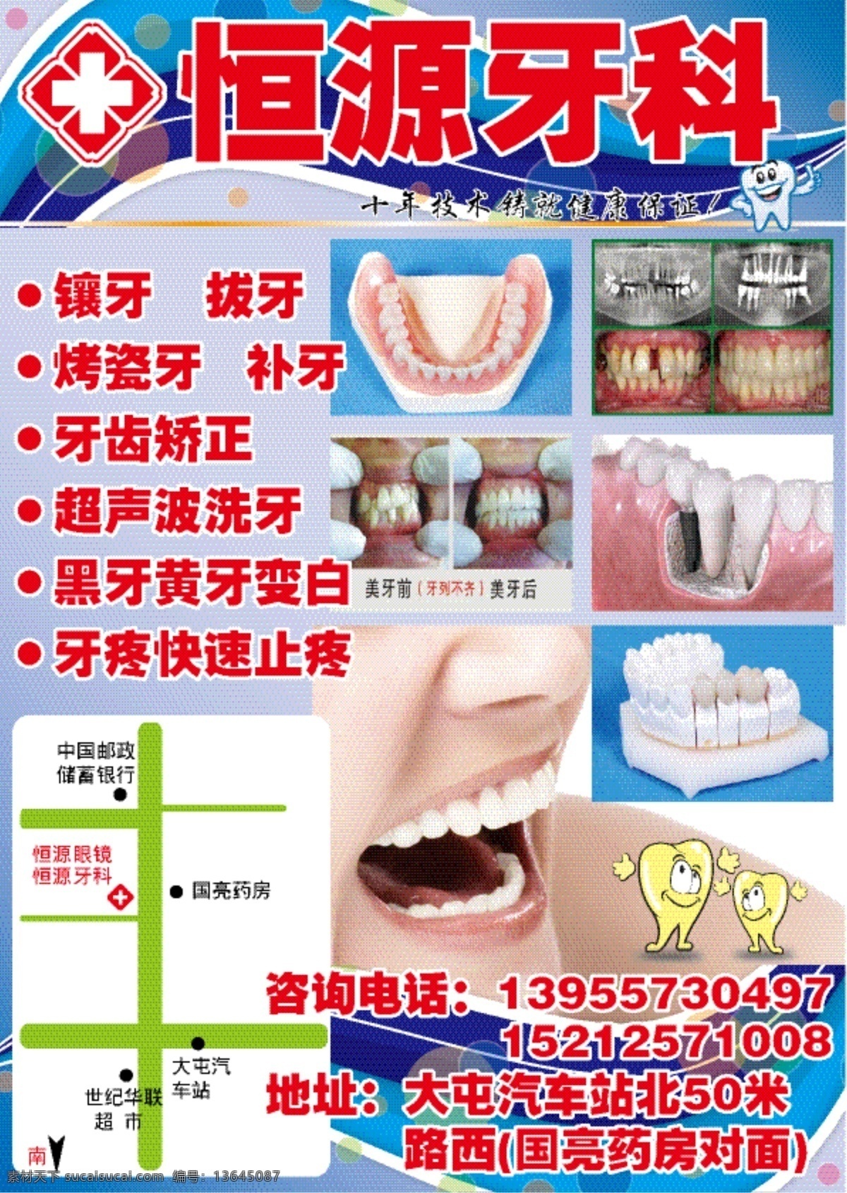 牙科 診所 假牙 義齒 烤瓷牙 補牙 牙齒矯正 牙套 牙齒 牙模 牙疼 矢量