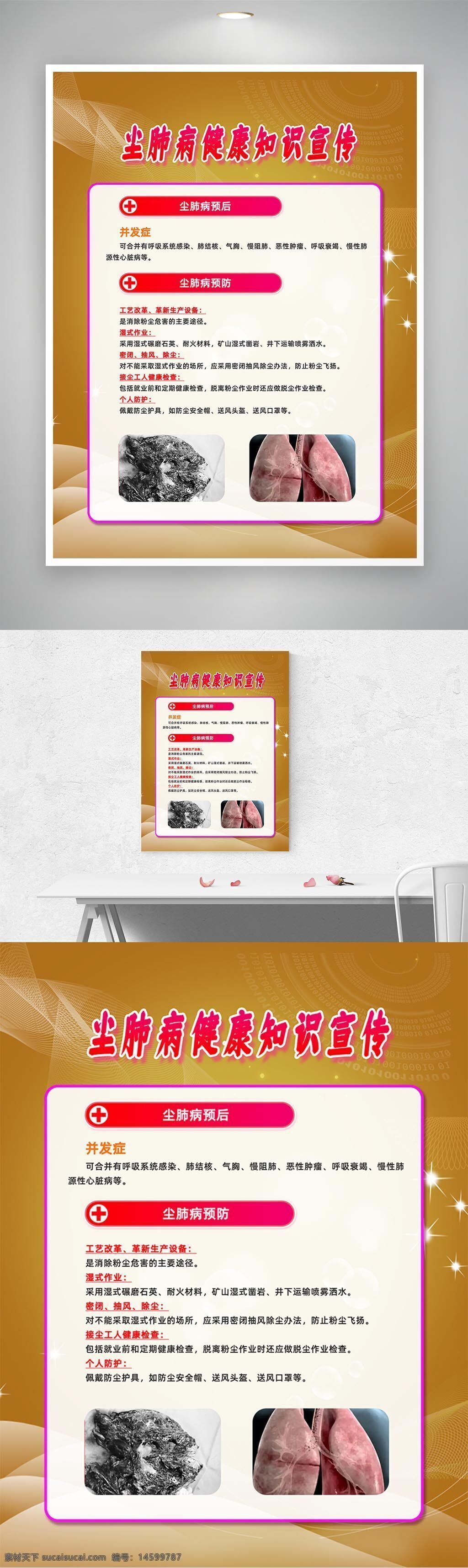 塵肺病 健康知識 塵肺病預(yù)后 并發(fā)癥 呼吸系統(tǒng)疾病 胸膜炎 氣胸 慢性阻塞性肺病 肺心病 預(yù)防 工藝改進 降塵措施 隔離操作 密閉操作 防塵設(shè)備 個人防護 健康監(jiān)測 職業(yè)健康 安全生產(chǎn)