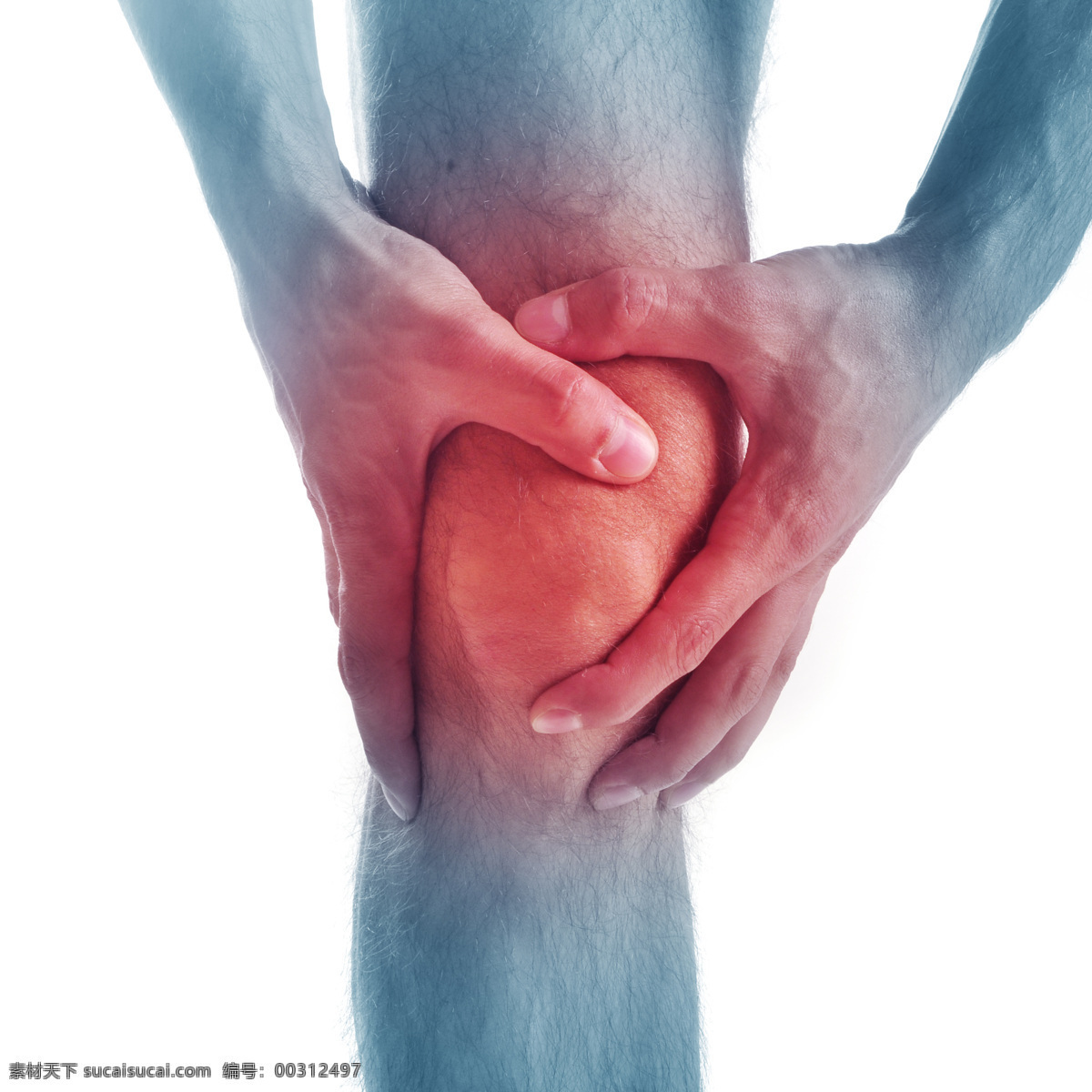 膝盖 受伤 男人 骨折 身体红肿 医疗护理 生病 生理疾病 受伤人物 现代科技