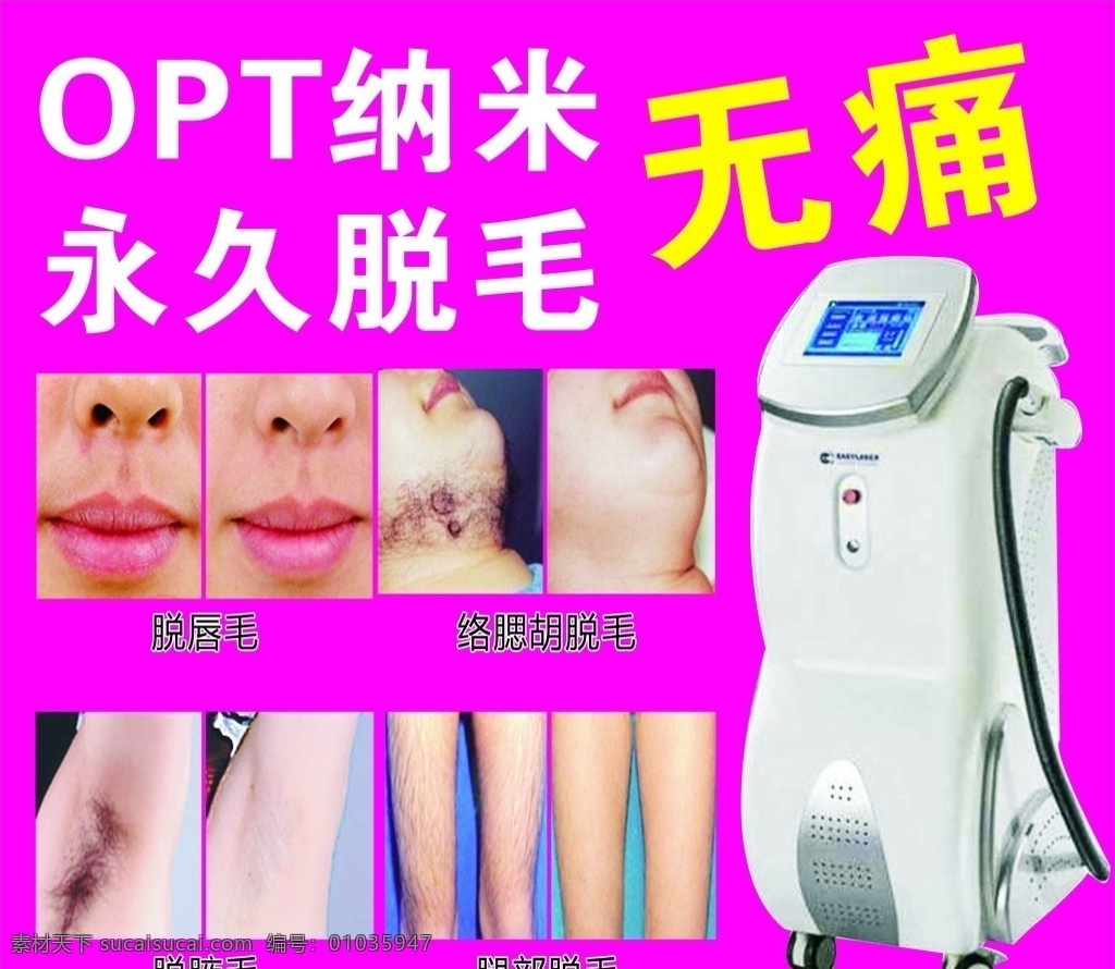 opt脱毛 无痛脱毛 纳米脱毛 机械脱毛 脱毛 背胶 海报展架