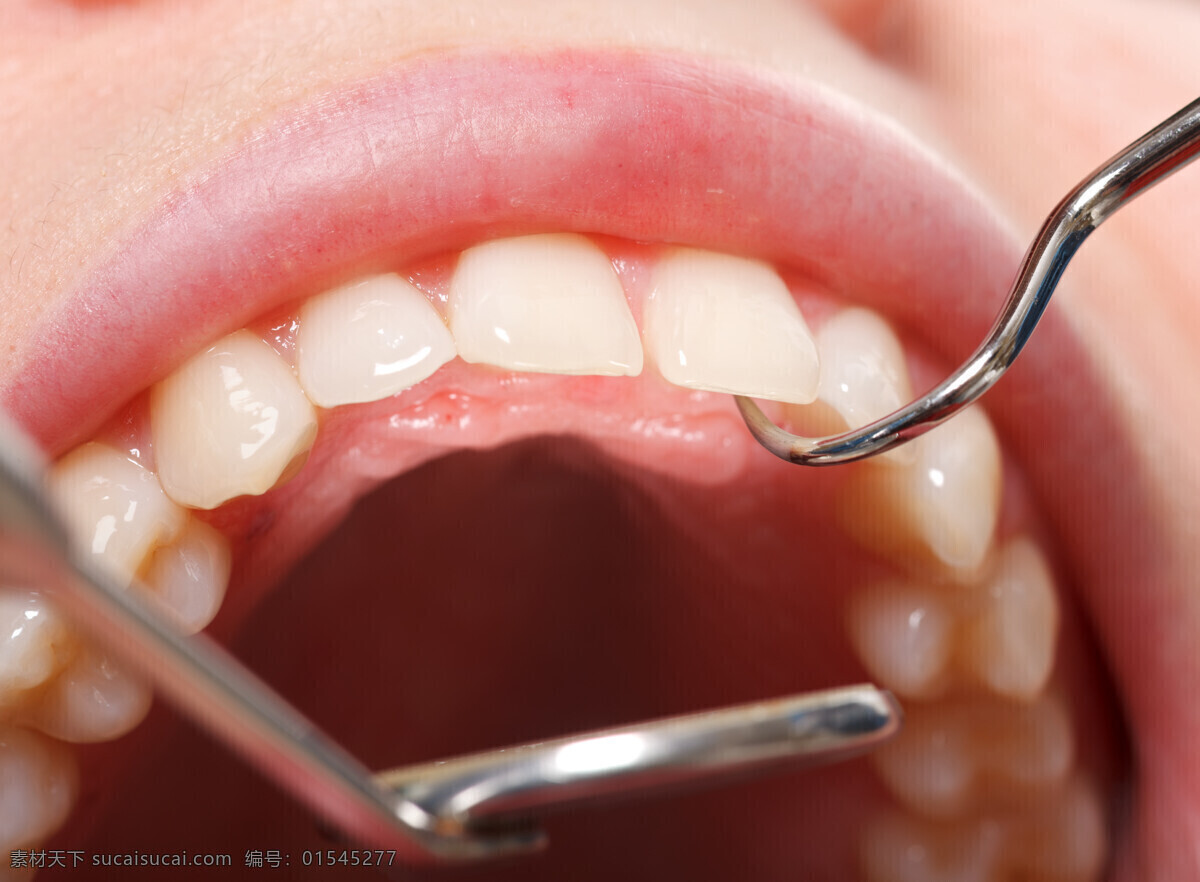 正在 治疗 牙齿 口腔 医疗器械 医疗护理 现代科技