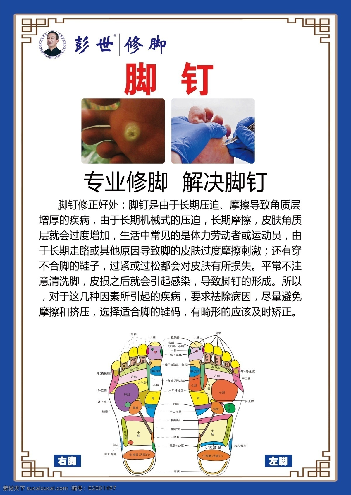 足疗 修脚 修复 海报 甲乐康 灰指甲 灰指甲治疗 灰指甲传染 灰指甲危害 灰指甲要害 家传秘方 传染病 灰指甲海报 脚癣 足癣 手癣 真菌感染 传单 皮炎 脚气