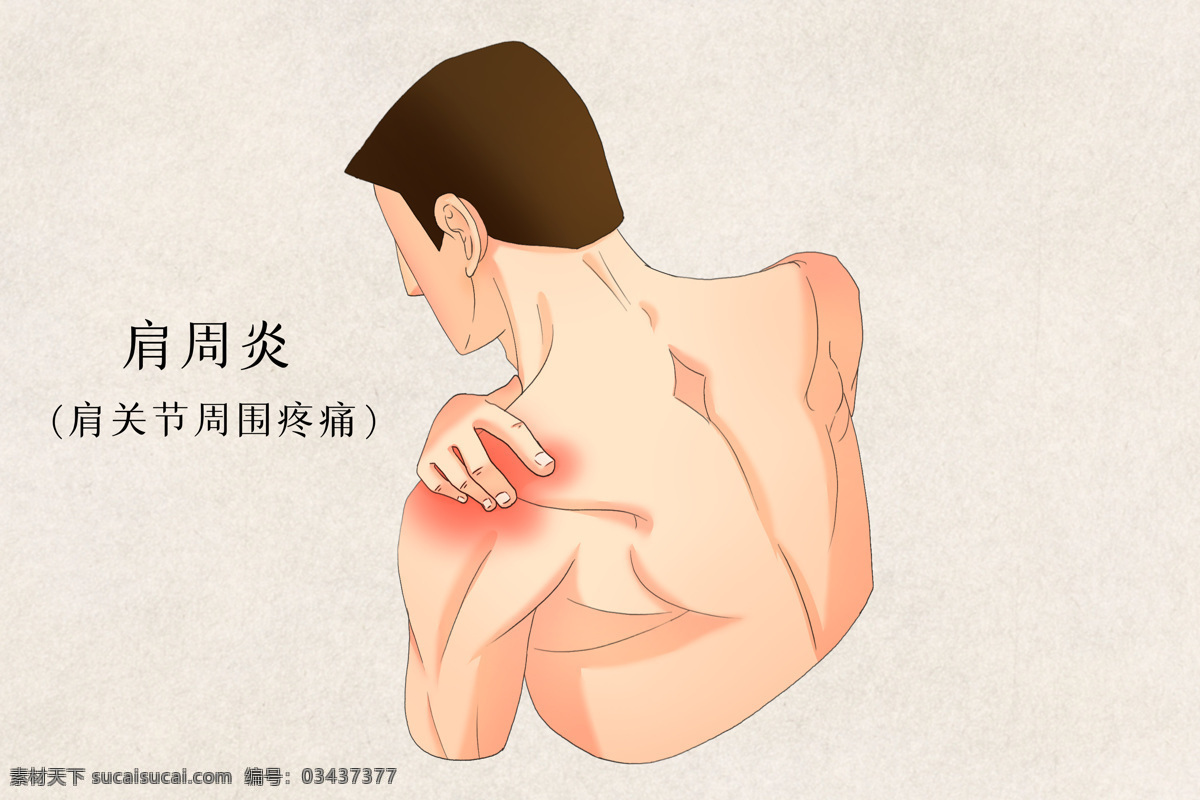 肩周炎 疾病 养生 背景 海报 素材图片
