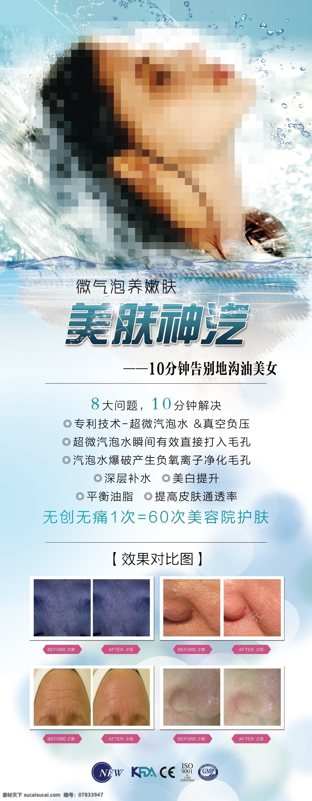微 气泡 氧 易拉宝 微气泡 整形 美容 洁肤 嫩肤 清洁 皮肤 整形美容