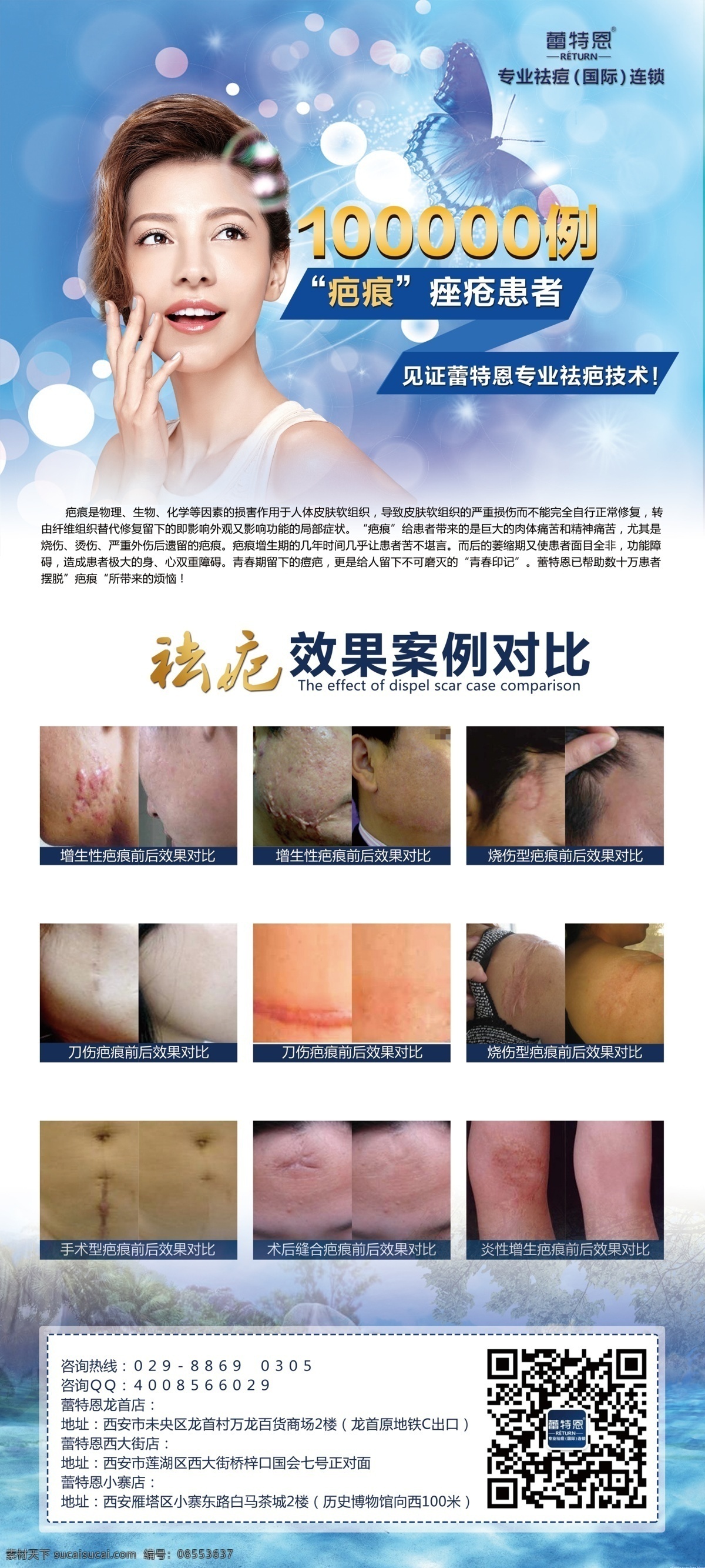 易拉宝 展架 美容院 祛痘 去疤 企业 淘宝素材 淘宝设计 淘宝模板下载 白色