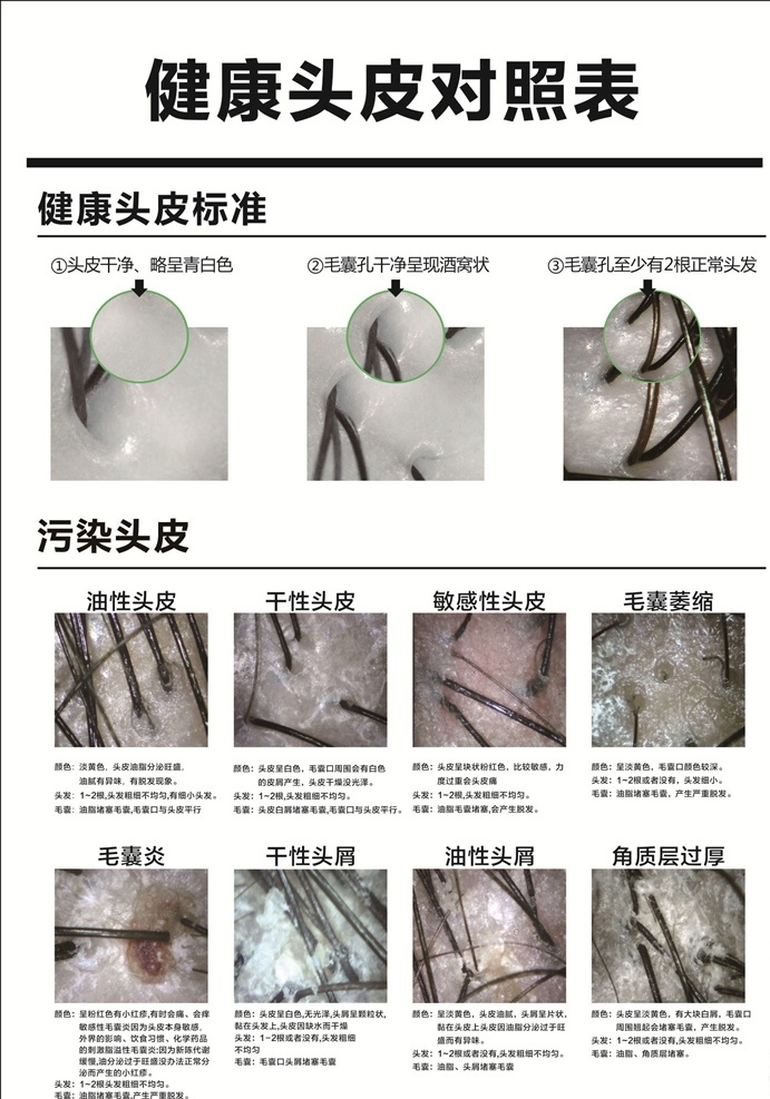 头皮对照表 健康头皮 头皮 毛囊 美发 头皮护理