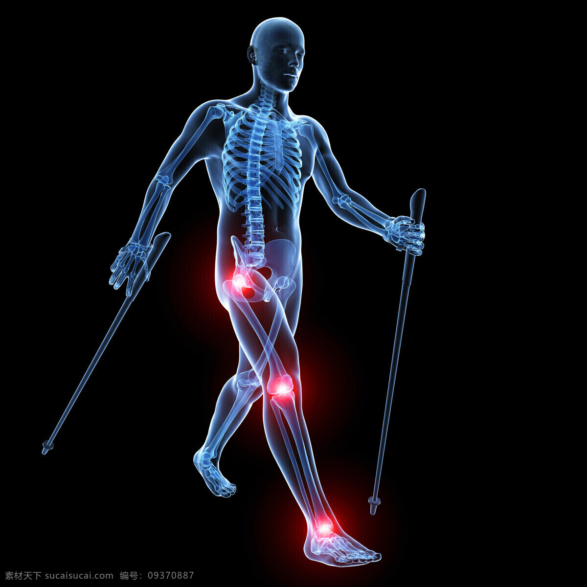 人体 医疗 透视图 医学 男性 男人 身体 模型 3d模型 立体图 病症 症状 关节 疼痛 酸痛 受伤 运动损伤 腿部 拐杖 拐棍 x光透射 骨骼 人体构造 高清图片 交通工具 现代科技
