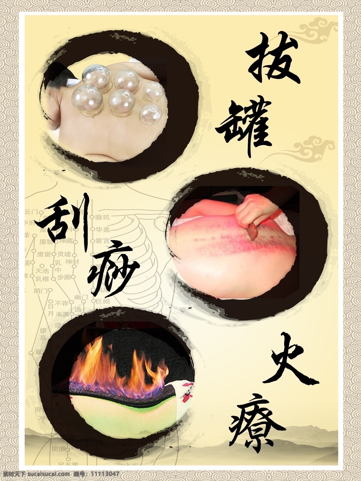 权健理疗 拔罐 刮痧 火疗 淡黄底色 洗浴中心