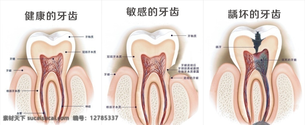 健康的牙齿 牙齿结构 敏感的牙齿 龋坏的牙齿 牙齿解剖