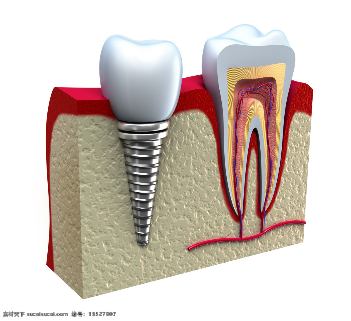 牙齿 模型 牙齿模型 安牙齿 保护牙齿 牙科 健康牙齿 人体器官图 人物图片