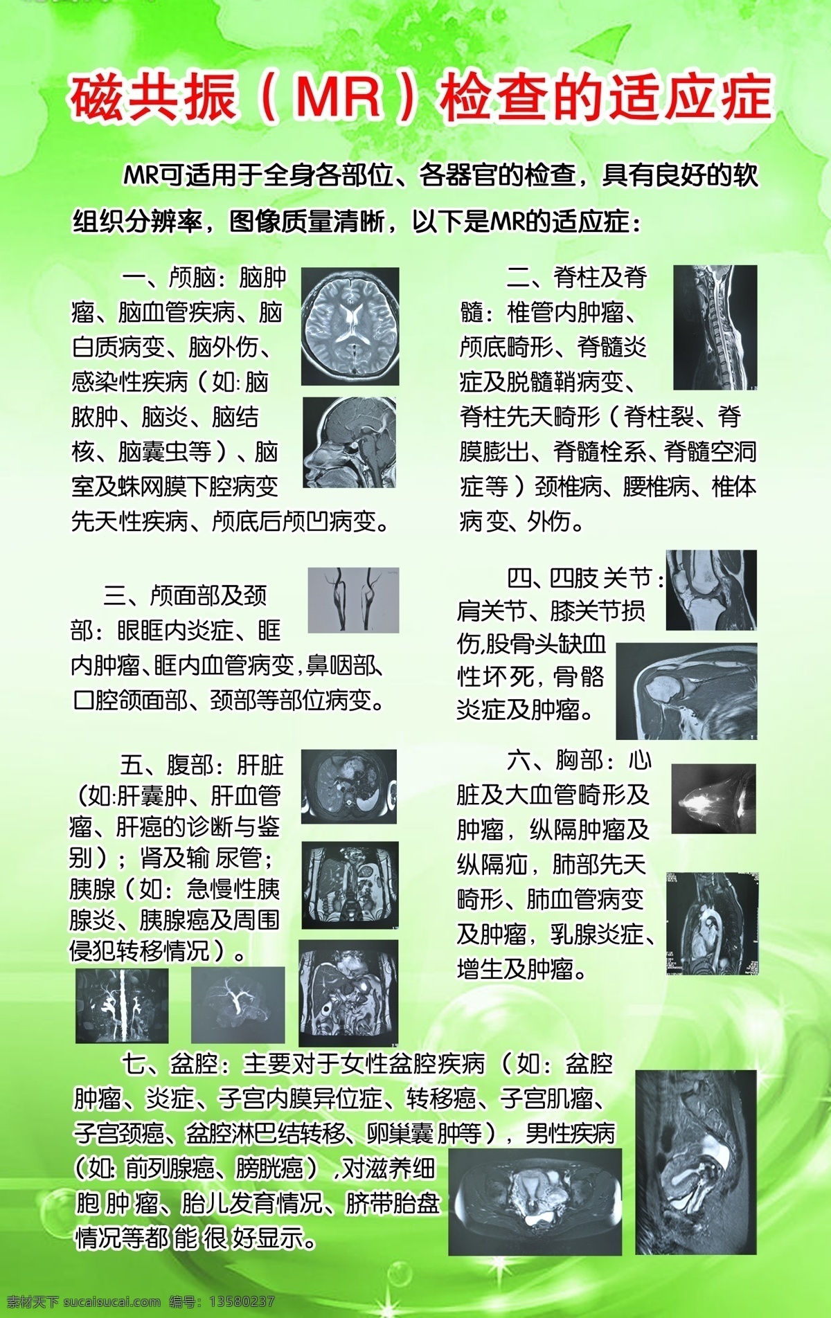 磁共振 检查 适应症 mr 核磁 西门子核磁 15t 展板模板 广告设计模板 源文件