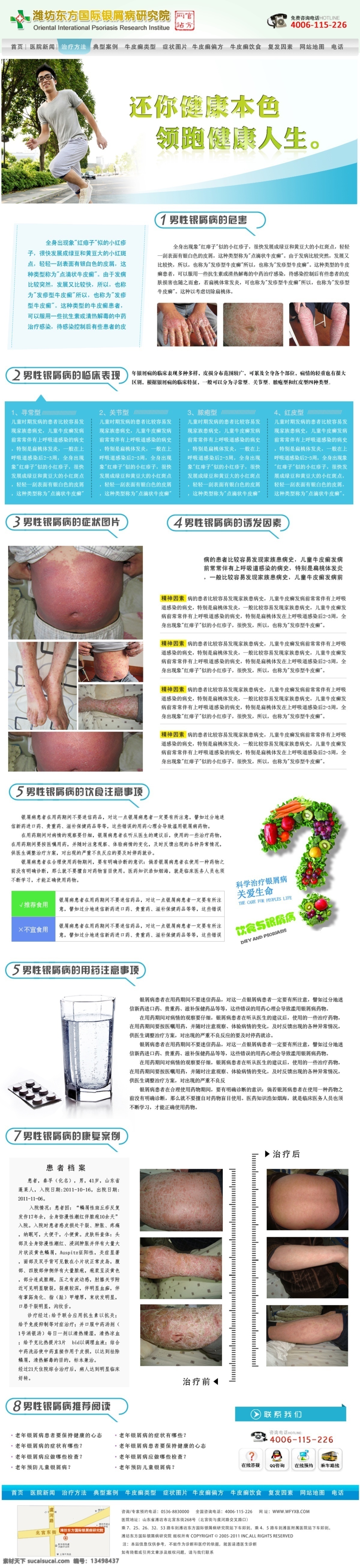 网站专题 单页 分类 分层 牛皮癣 男性 银屑病 web 界面设计 中文模板