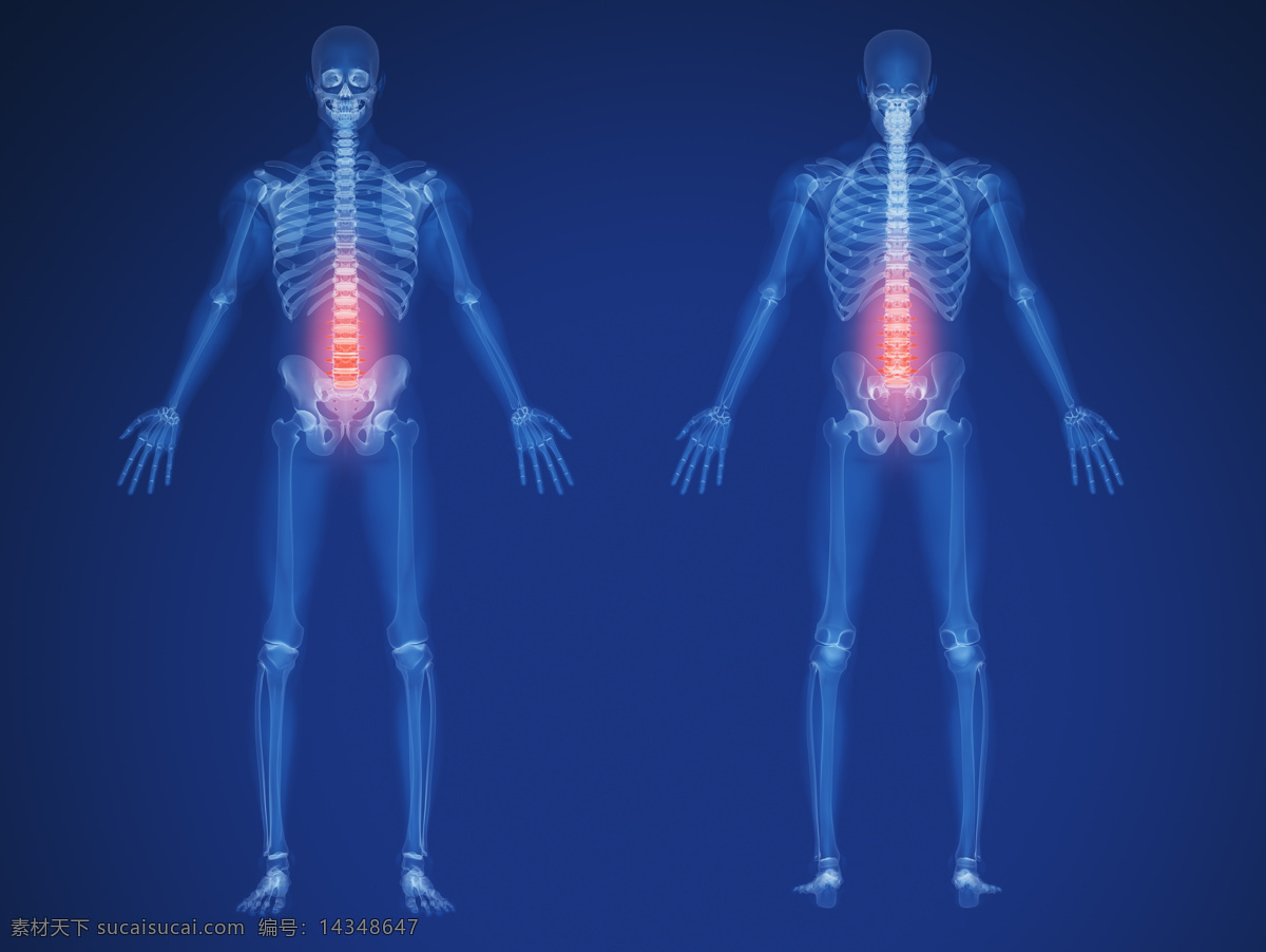 人体 脊椎 x 光 透视图 x光 图像 医疗主题 医疗护理 现代科技